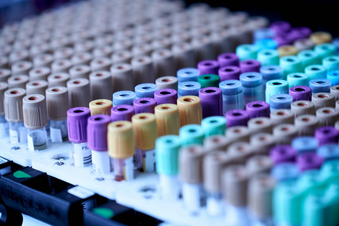 Vials of medical tests in a lab